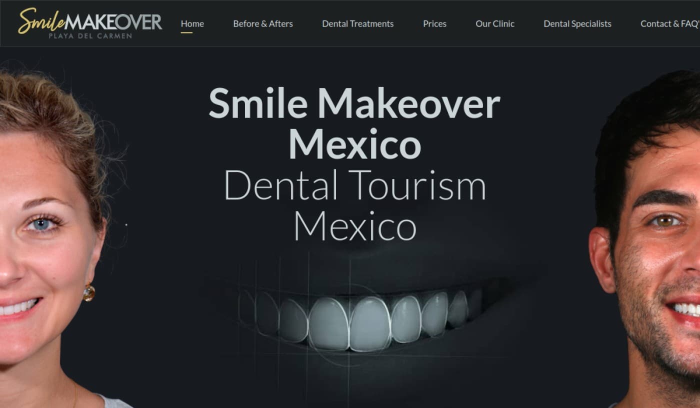 Smile Makeover Mexico in playa del carmen
